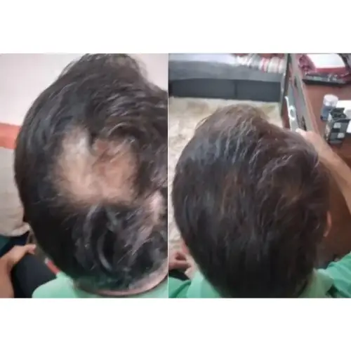 Imagem enviada de fibra capilar TOPIK